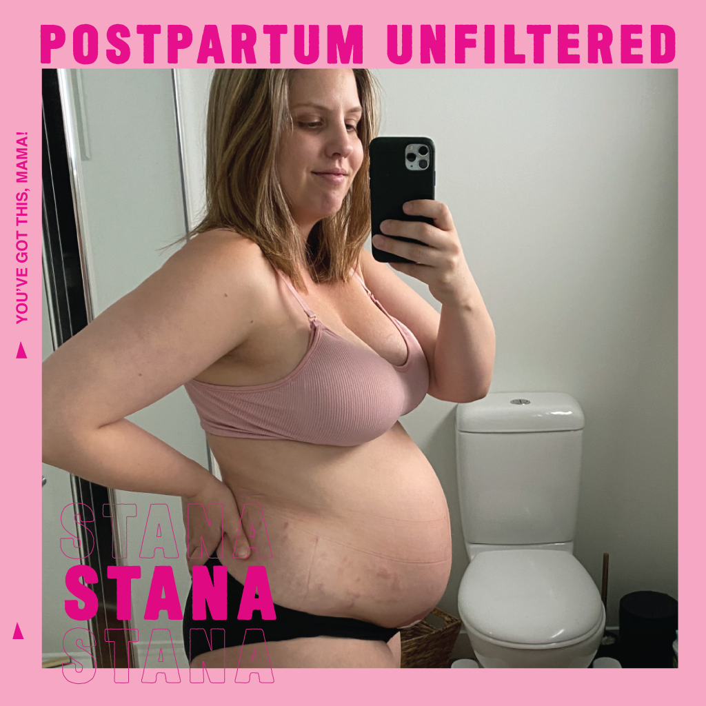 Stana's Postpartum Unfiltered
