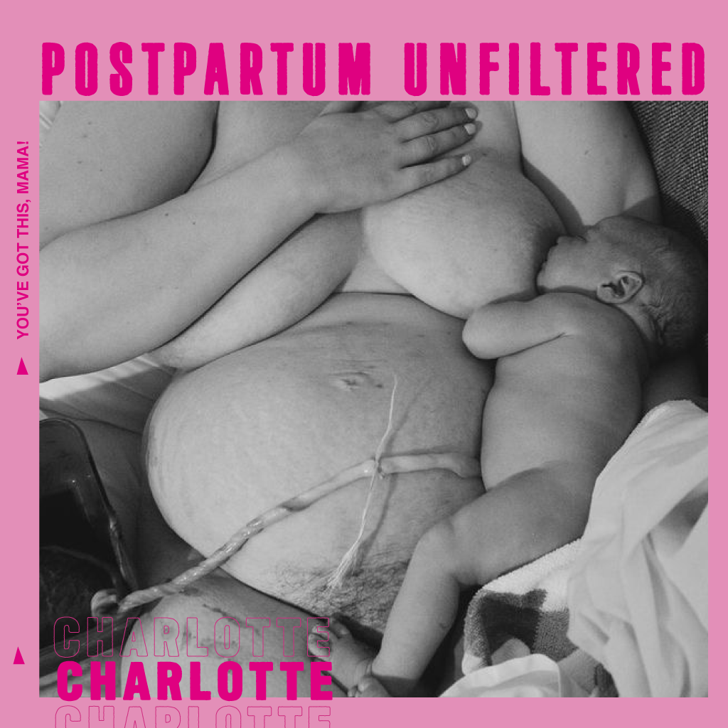 Charlotte's Postpartum Unfiltered