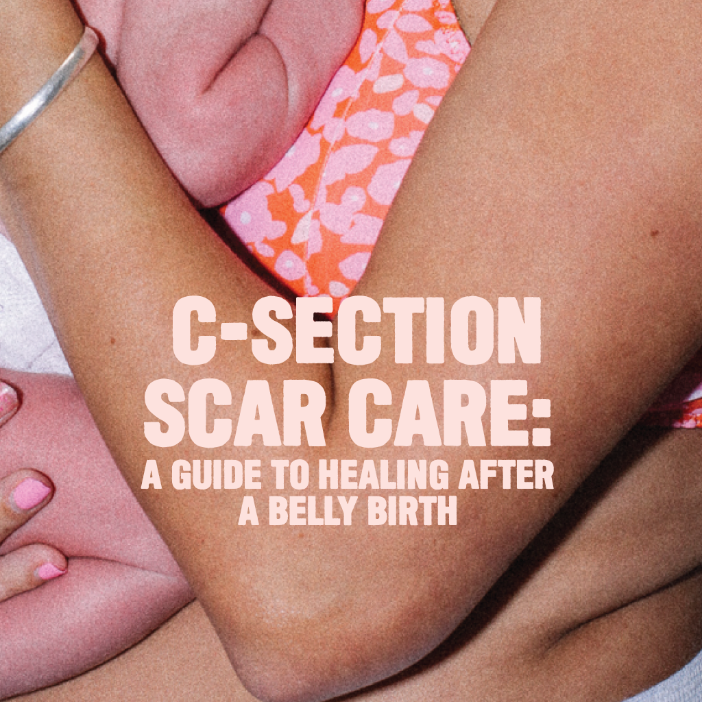 C-Section Scar Care: A Guide to Healing After a Belly Birth