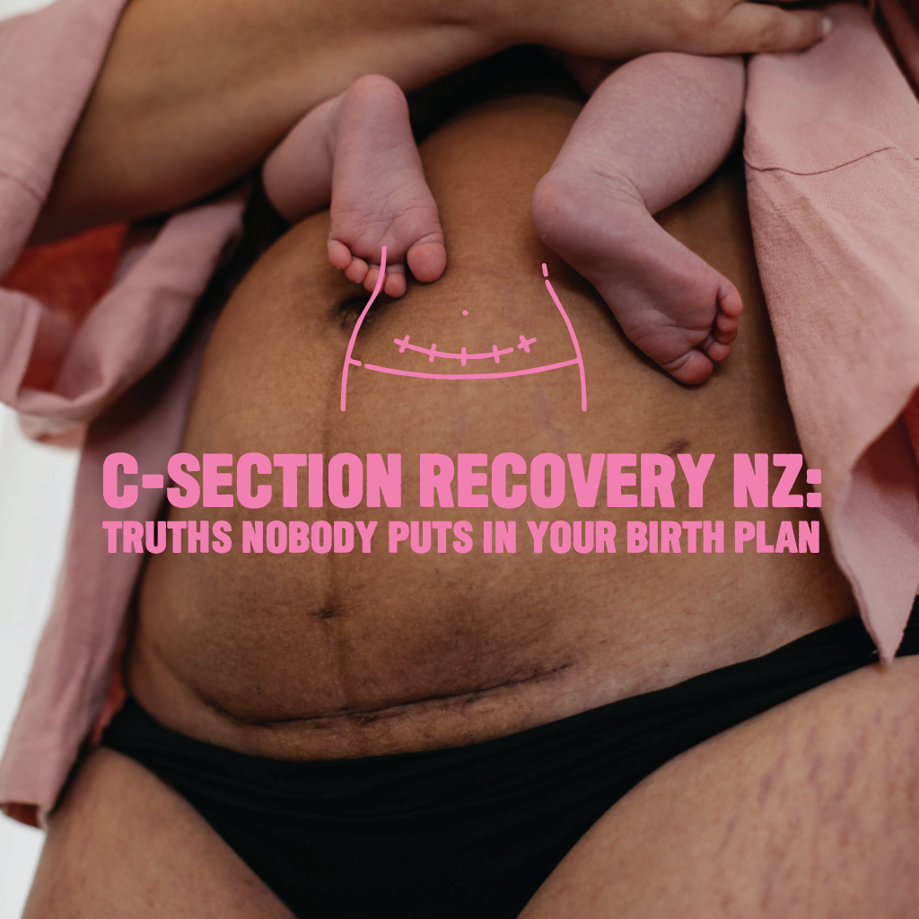 C-Section Recovery NZ: Truths Nobody Puts in Your Birth Plan