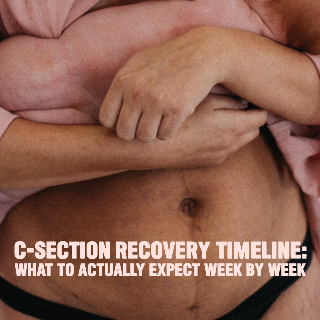 C-Section Recovery Timeline: What to ACTUALLY Expect Week by Week