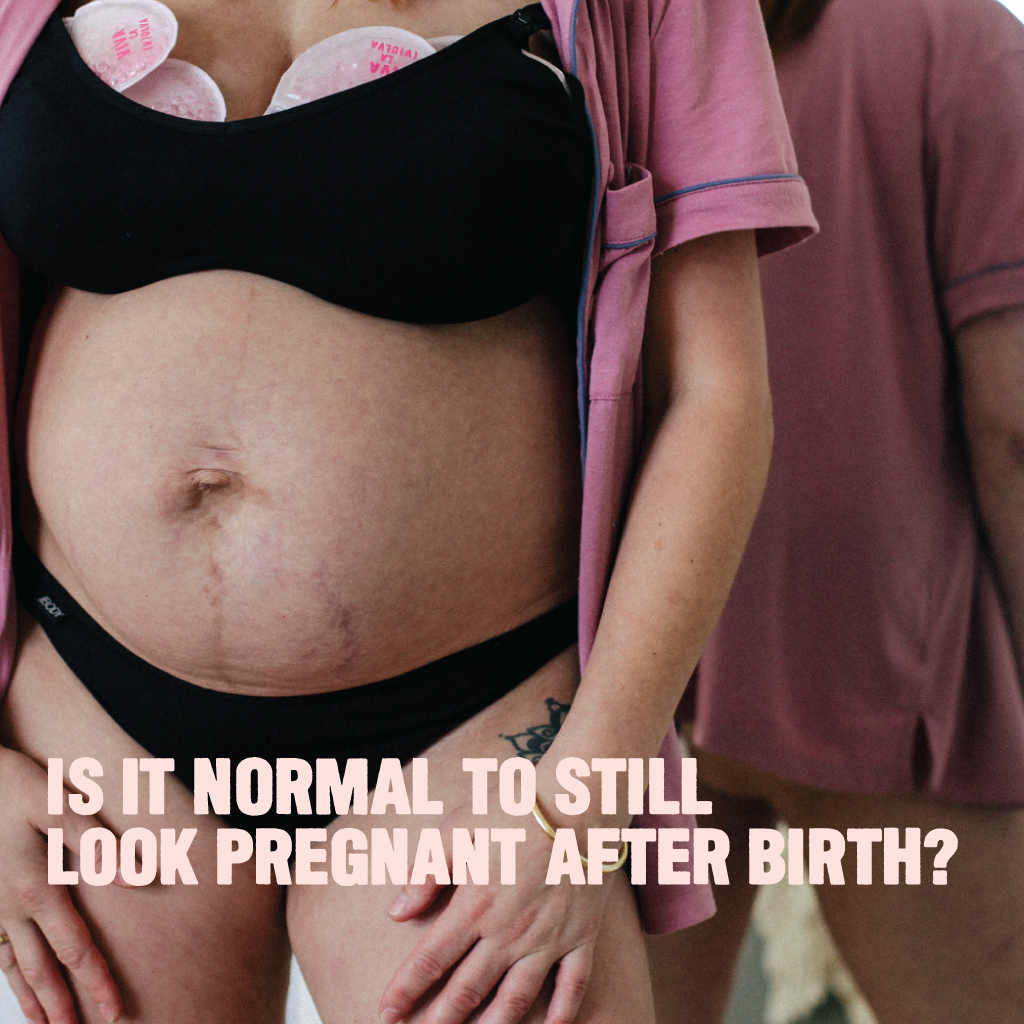 Is It Normal to Still Look Pregnant After Birth?