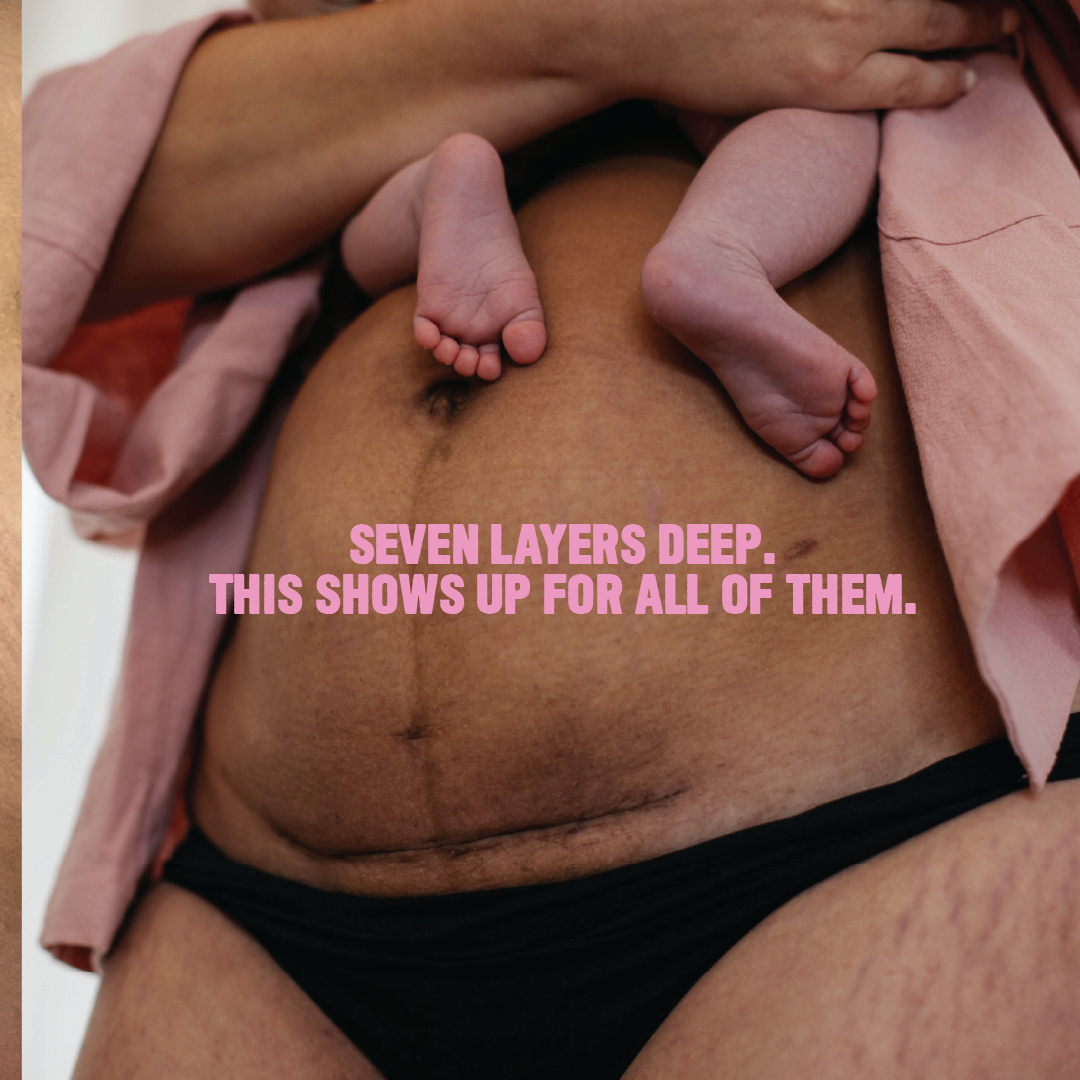 Belly Birth Scar Oil - Your C-Section Scar Massage Essential